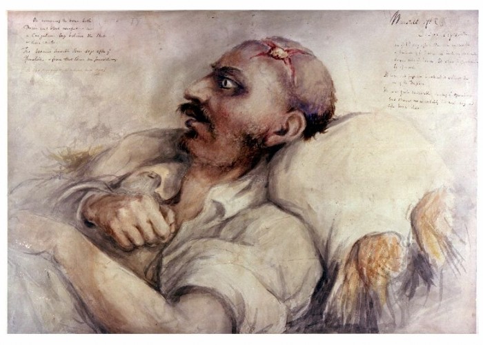 Watercolour Painting of Waterloo Injuries, by Dr. Charles Bell. Copyright Army Medical Services Museum.
