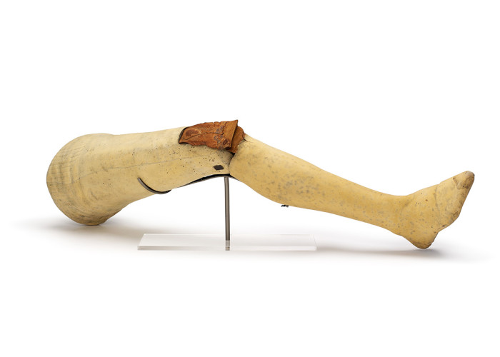 An early version of an artifical leg