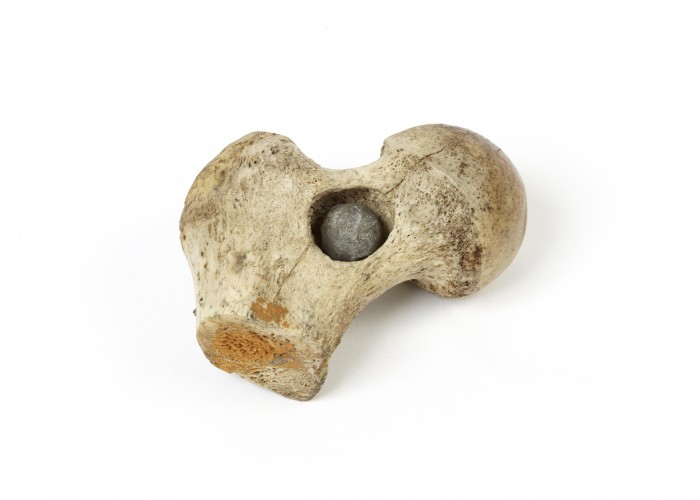Femur of a soldier killed at Waterloo, with embedded musket ball. Copyright Surgeons' Hall Museum.