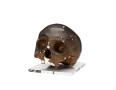 Skull of Corporal John Shaw
